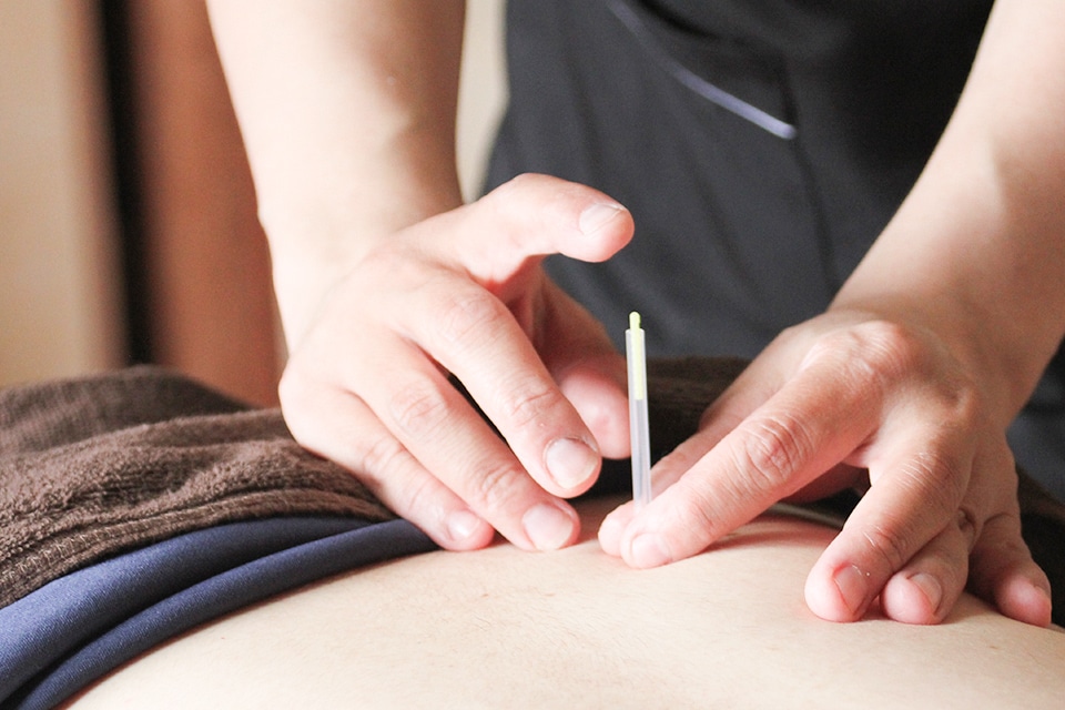 鍼灸治療
